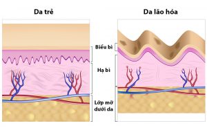 dac-diem-da-lao-hoa-thuong-bi-va-trung-bi